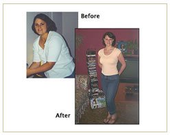 Slider image (3) The Bariatric Group